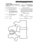 Dynamized Interspinal Implant diagram and image