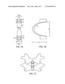 Dynamized Interspinal Implant diagram and image