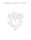 EXPANDABLE INTERSPINOUS DEVICE diagram and image