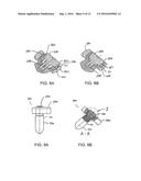 ORTHOPEDIC ANCHOR ASSEMBLY diagram and image