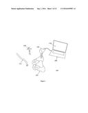 SYSTEMS, METHODS AND DEVICES FOR ANATOMICAL REGISTRATION AND SURGICAL     LOCALIZATION diagram and image