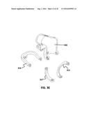 ADAPTING MANUAL LAPAROSCOPIC SURGICAL INSTRUMENTS FOR ROBOTIC TELESURGERY     APPLICATIONS diagram and image