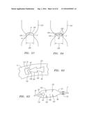 Heart Valve Assemblies diagram and image