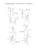 Heart Valve Assemblies diagram and image