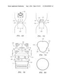 Heart Valve Assemblies diagram and image