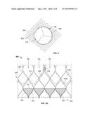 PARAVALVULAR LEAK SEALING MECHANISM diagram and image