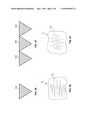 PARAVALVULAR LEAK SEALING MECHANISM diagram and image