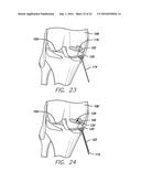 METHOD FOR AMELIORATING JOINT CONDITIONS AND DISEASES AND PREVENTING BONE     HYPERTROPHY diagram and image