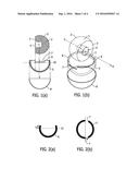 SYSTEM AND METHOD FOR IMPROVED CONSTRAINED PROSTHETIC ACETABULUM diagram and image