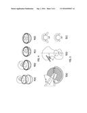 SYSTEM AND METHOD FOR IMPROVED CONSTRAINED PROSTHETIC ACETABULUM diagram and image