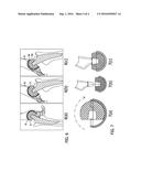 SYSTEM AND METHOD FOR IMPROVED CONSTRAINED PROSTHETIC ACETABULUM diagram and image