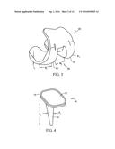 Gender Specific Implant and Packaging diagram and image