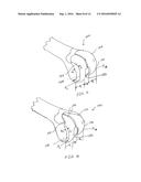 Gender Specific Implant and Packaging diagram and image