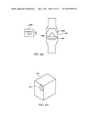 Gender Specific Implant and Packaging diagram and image