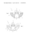 NEGATIVE-POSITIVE PRESSURIZABLE IMPLANT diagram and image