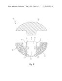 NEGATIVE-POSITIVE PRESSURIZABLE IMPLANT diagram and image