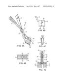 METHODS AND APPARATUS FOR INTERVERTEBRAL DISC PROSTHESIS INSERTION diagram and image