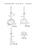 METHODS AND APPARATUS FOR INTERVERTEBRAL DISC PROSTHESIS INSERTION diagram and image