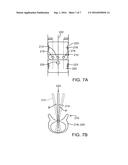 METHODS AND APPARATUS FOR INTERVERTEBRAL DISC PROSTHESIS INSERTION diagram and image