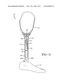 PROSTHETIC DEVICE UTILIZING ELECTRIC VACUUM PUMP diagram and image