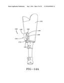 PROSTHETIC DEVICE UTILIZING ELECTRIC VACUUM PUMP diagram and image