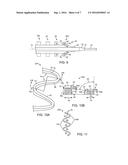 STENT WITH EASED CORNER FEATURE diagram and image