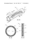 LAYERED MEDICAL APPLIANCES AND METHODS diagram and image