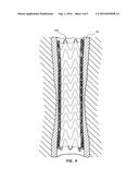 LAYERED MEDICAL APPLIANCES AND METHODS diagram and image