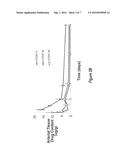 Methods of Treatment with Drug Eluting Stents with Prolonged Local Elution     Profiles with High Local Concentrations and Low Systemic Concentrations diagram and image