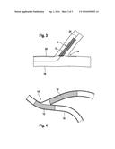 STENT COMPRISING A RETAINING ELEMENT diagram and image