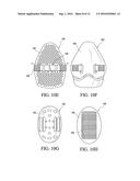 SPINAL ORTHOSIS, KIT AND METHOD FOR USING THE SAME diagram and image