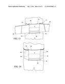 SPINAL ORTHOSIS, KIT AND METHOD FOR USING THE SAME diagram and image