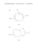 DEVICE FOR RECEIVING AN INTRAOCULAR LENS, AND METHOD FOR FOLDING AN     INTRAOCULAR LENS diagram and image