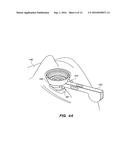 PATIENT INTERFACE FOR OPHTHALMOLOGIC DIAGNOSTIC AND INTERVENTIONAL     PROCEDURES diagram and image