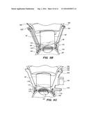 PATIENT INTERFACE FOR OPHTHALMOLOGIC DIAGNOSTIC AND INTERVENTIONAL     PROCEDURES diagram and image