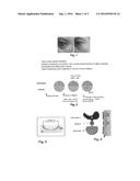 Cosmetic formulation and device for the treatment of deep wrinkles of the     skin by means of  iontophoresis diagram and image