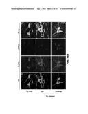 RAB7L1 INTERACTS WITH LRRK2 TO MODIFY INTRANEURONAL PROTEIN SORTING AND     PARKINSON S DISEASE RISK diagram and image