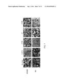 METHOD OF TREATING A MALIGNANCY IN A SUBJECT AND A PHARMACEUTICAL     COMPOSITION FOR USE IN SAME diagram and image