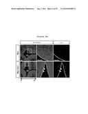 NERVE REGENERATING OR NERVE GROWTH-PROMOTING PHARMACEUTICAL COMPOSITION     CONTAINING VAX PROTEIN AS ACTIVE INGREDIENT diagram and image