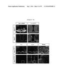 NERVE REGENERATING OR NERVE GROWTH-PROMOTING PHARMACEUTICAL COMPOSITION     CONTAINING VAX PROTEIN AS ACTIVE INGREDIENT diagram and image