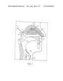 NASAL DELIVERY METHOD diagram and image