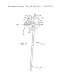 BI-LATERAL ENDOBRONCHIAL SUCTIONING DEVICE AND MEDICAL SUCTIONING SYSTEM     FOR INTUBATED PATIENTS diagram and image