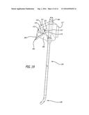 BI-LATERAL ENDOBRONCHIAL SUCTIONING DEVICE AND MEDICAL SUCTIONING SYSTEM     FOR INTUBATED PATIENTS diagram and image