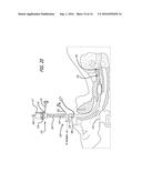 BI-LATERAL ENDOBRONCHIAL SUCTIONING DEVICE AND MEDICAL SUCTIONING SYSTEM     FOR INTUBATED PATIENTS diagram and image