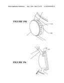 HME AND COMPACT BREATHING APPARATUS diagram and image