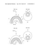 CATHETER diagram and image