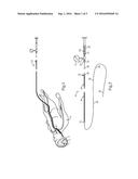 SOFT LOCK WIRE GUIDE AND NEURO-SURGERY ASSEMBLY USING SAME diagram and image