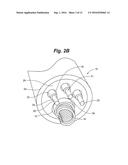 Method for Detecting and Localizing Insulation Failures of Implantable     Device Leads diagram and image