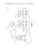 System, Device and Garment for Delivering Transcutaneous Electrical     Stimulation diagram and image