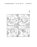 REVERSING COGNITIVE-MOTOR IMPAIRMENTS IN PATIENTS HAVING A     NEURO-DEGENERATIVE DISEASE USING A COMPUTATIONAL MODELING APPROACH TO     DEEP BRAIN STIMULATION PROGRAMMING diagram and image